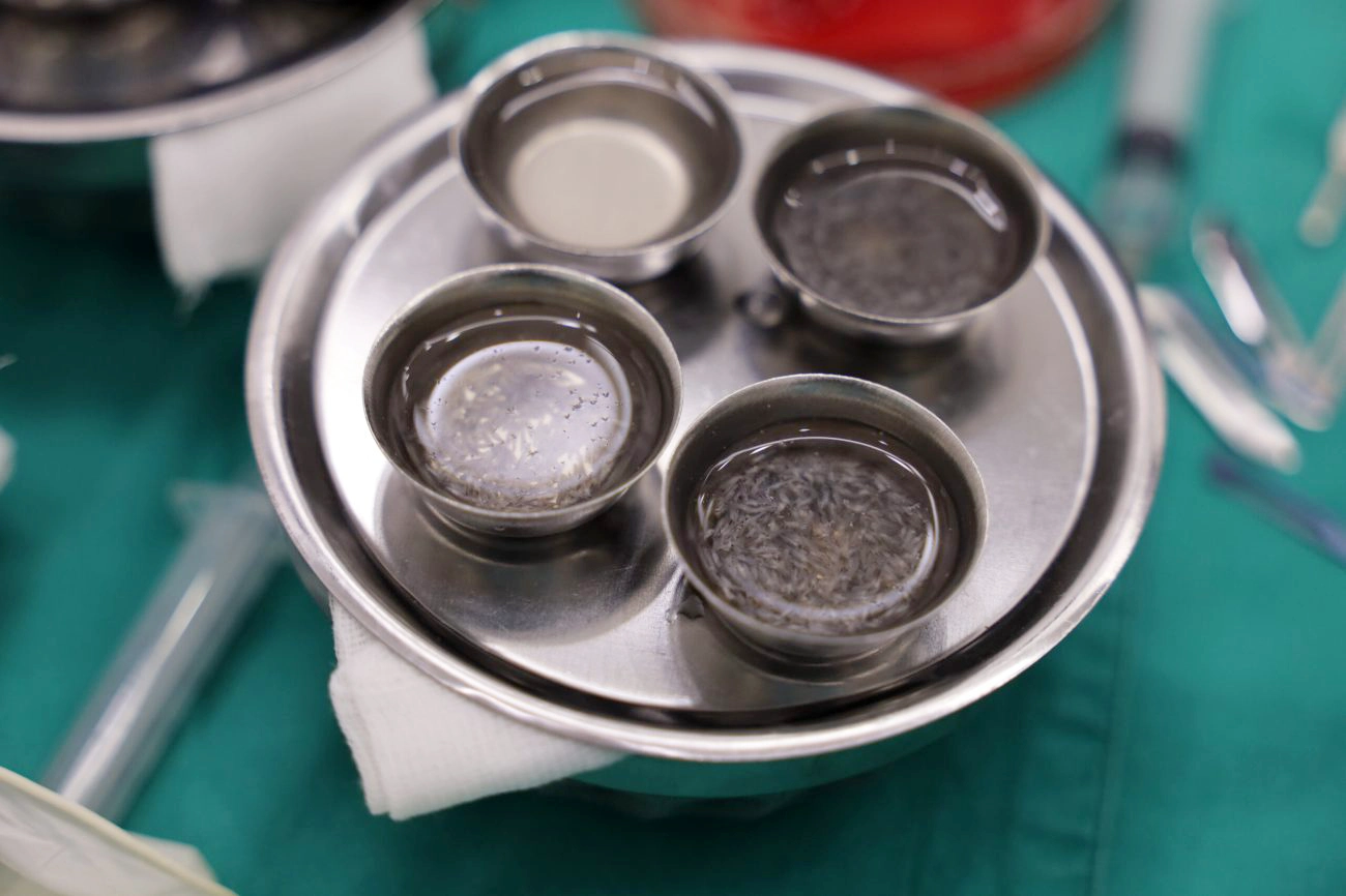 รากผมที่เจาะออกมาแช่น้ำเลี้ยงเซลล์