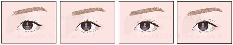 ตาสองชั้น แบบไหนสวยธรรมชาติและเข้ากับใบหน้าสำหรับปี 2025