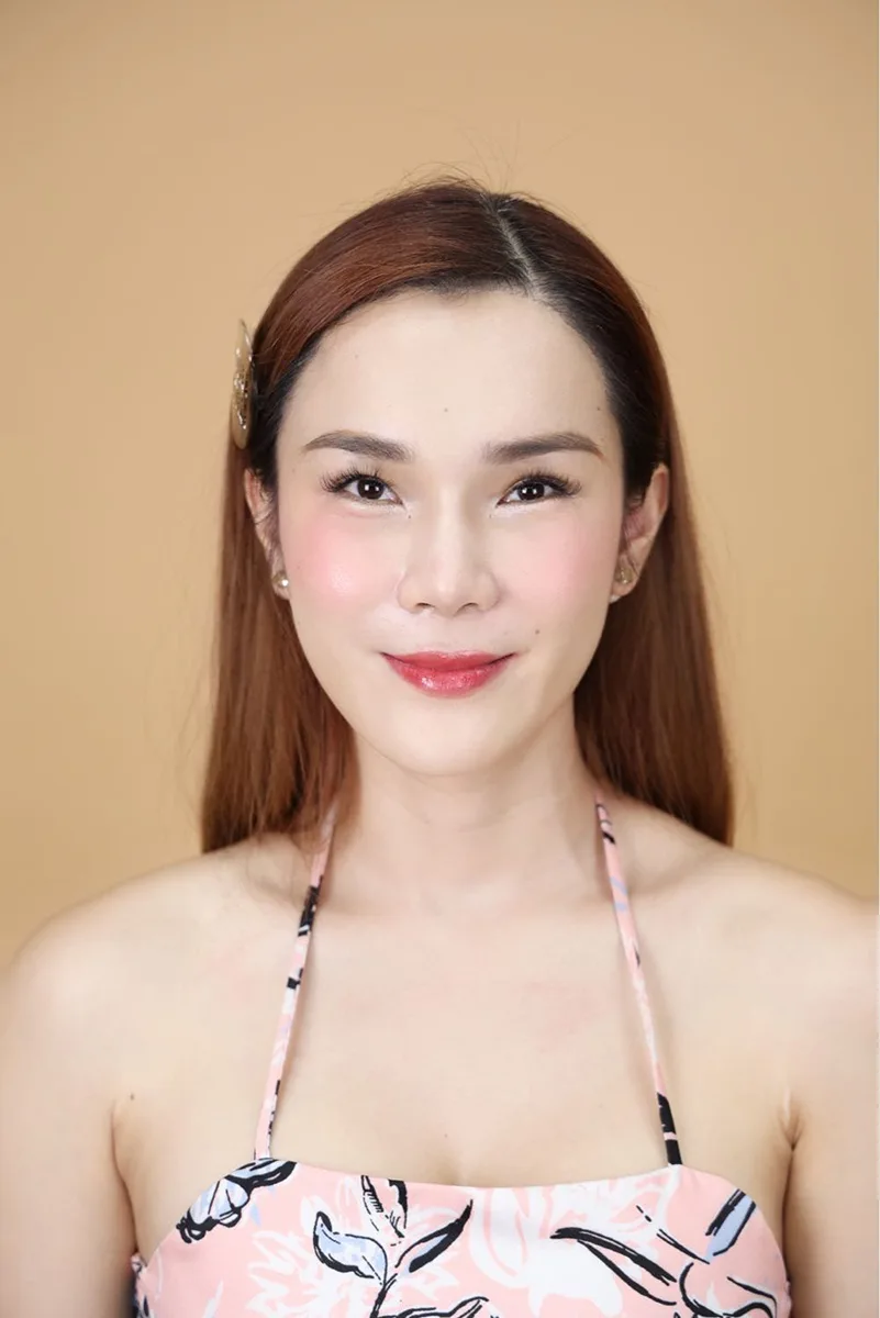 ทำตาสองชั้น_Facebody Clinic__คุณเจ (11)