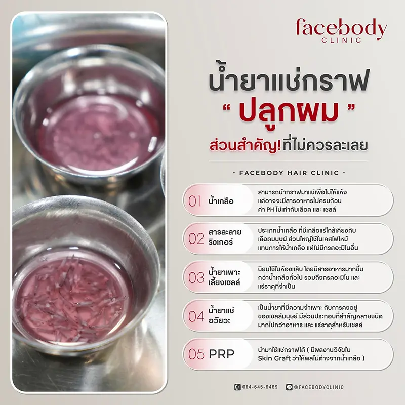 น้ำยาแช่กราฟท์ (Storage Solution หรือ Graft Holding Solution) คือสารที่ใช้สำหรับรักษาสภาพของกราฟผม (Graft) เมื่ออยู่ภายนอกร่างกาย เพื่อให้อยู่ในสภาพที่ดีก่อนนำไปผ่าตัดปลูกผม ทั้งกราฟที่ได้จากการปลูกผม FUE และการปลูกผม FUT