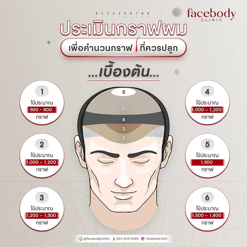 ประเมินกราฟผม บริเวณที่ปลูกผม