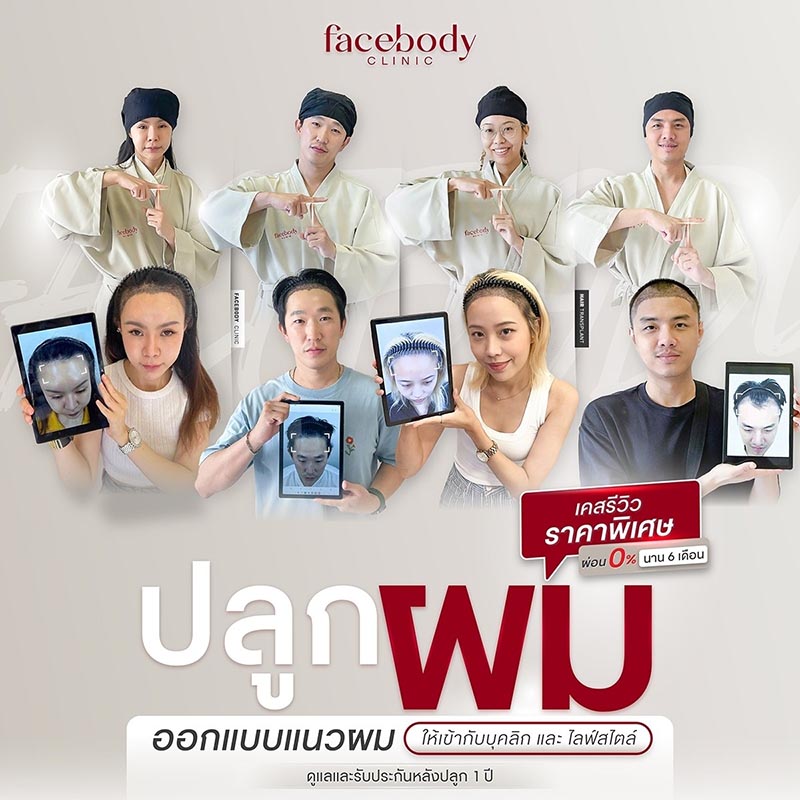 ปลูกผม เหมาะกับผู้ที่มีปัญหาผมร่วงจากพันธุกรรมหรือลักษณะผมบาง แต่ไม่เหมาะสำหรับคนที่มีแผลเป็นบนหนังศีรษะ โดยแนะนำให้รักษาแผลเป็นนั้นให้หายก่อนประมาณ 6 เดือนเพื่อให้ผลการปลูกผมมี