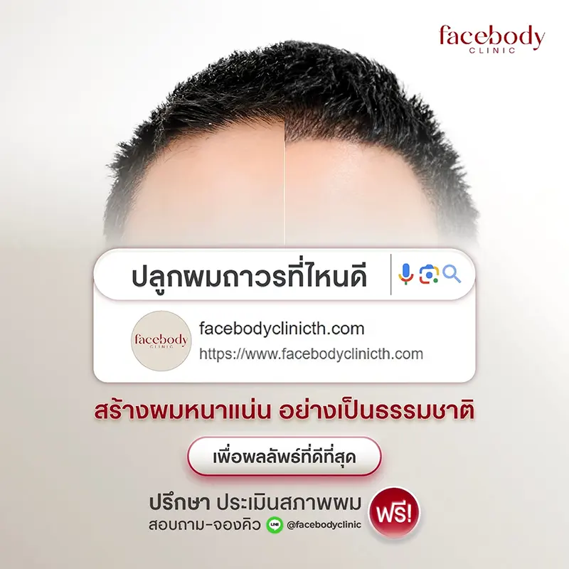 ปลูกผมที่ไหนดี 2567