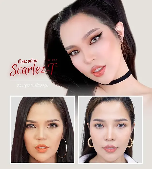 ทำตาสองชั้น ปลูกผม ยกคิ้ว ฟิลเลอร์