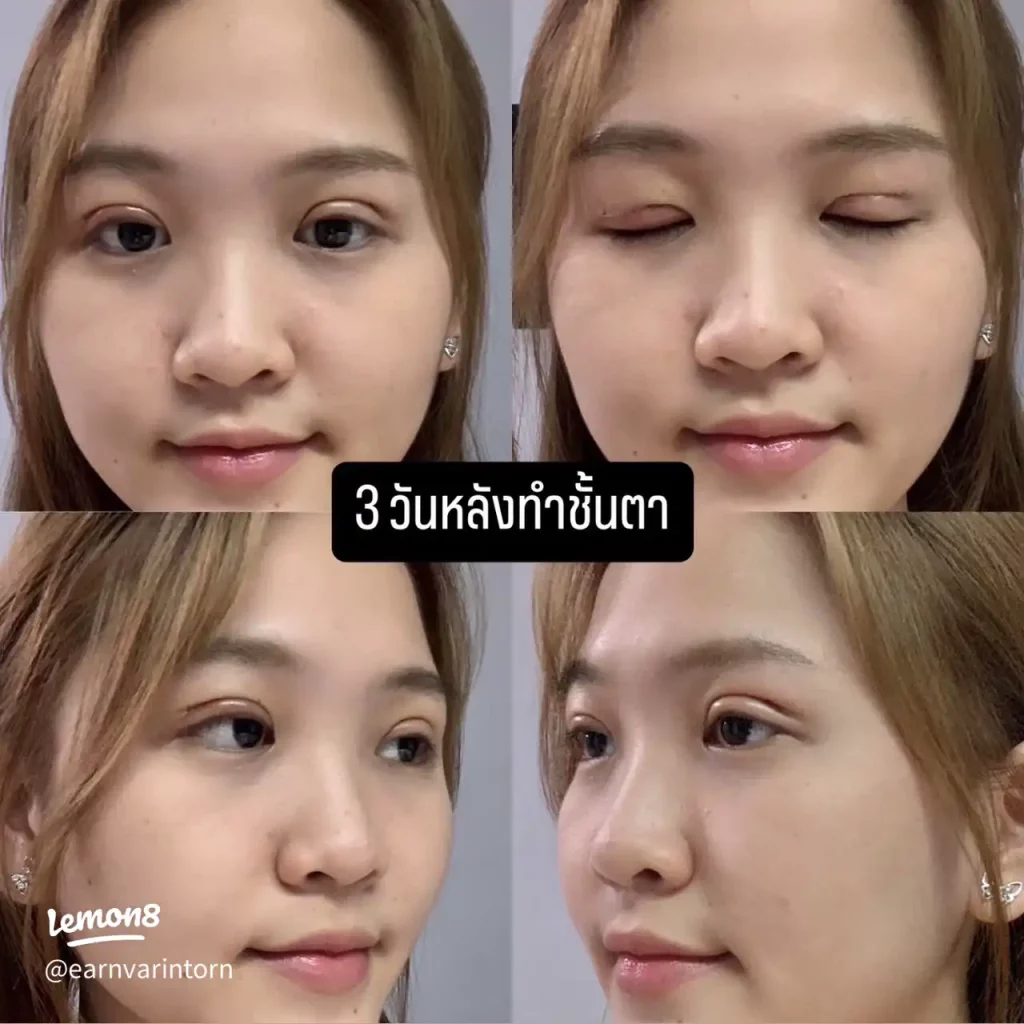 ทำตาสองชั้น