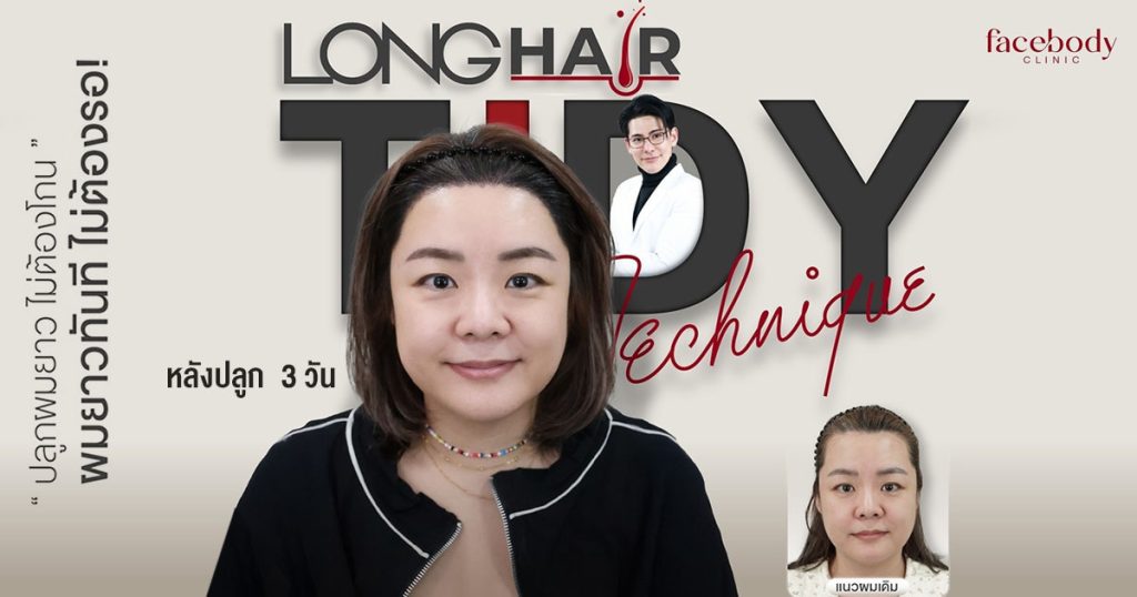 ปลูกผมไม่ต้องโกน ผมยาว