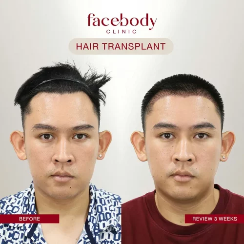 BA ผู้ชาย (22)