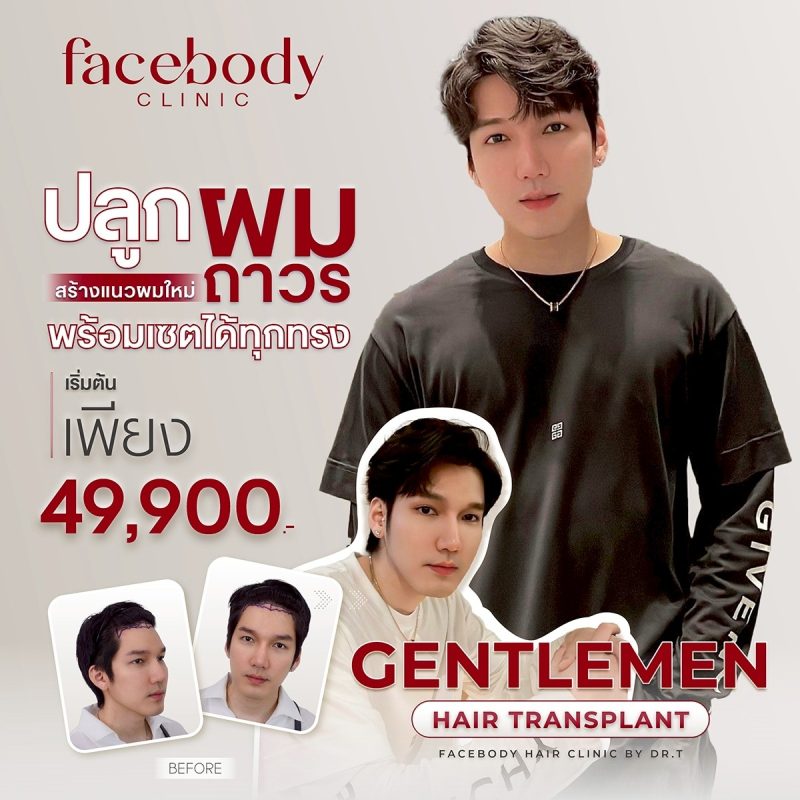 PRO ปลูกผมเริ่มต้น 49900
