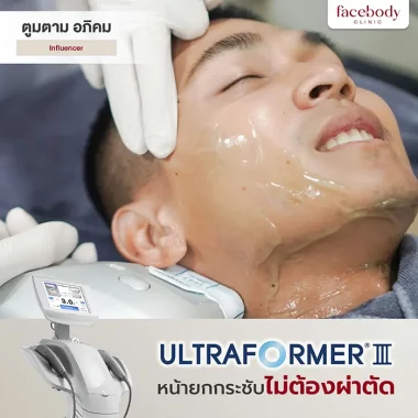 ULTRAFORMER III (14)