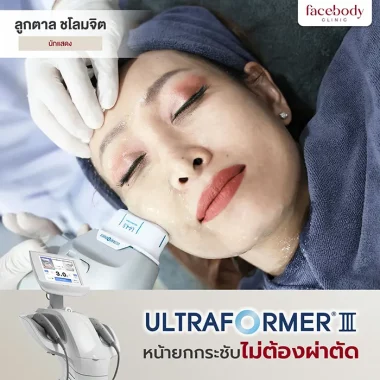 ULTRAFORMER III (20)