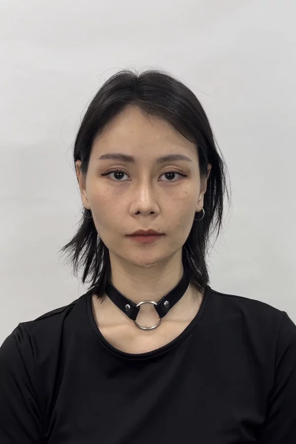 ฉีด ฟิลเลอร์ใต้ตา