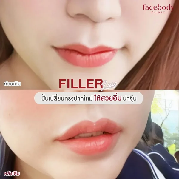 น่าจุ๊บ