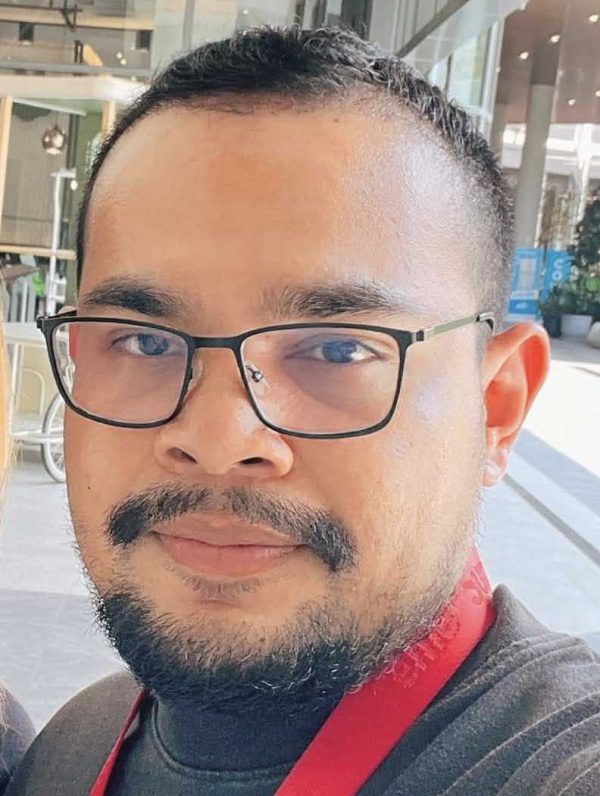 ปลูกผม คุณวายุ 2