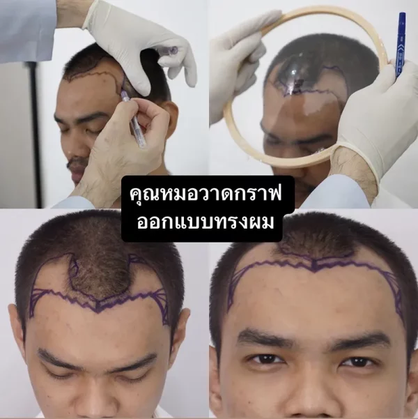 รีวิว ผม 1 ปี (3)