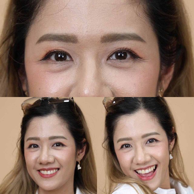 รีวิวทำตาสองชั้น คุณจูน 3