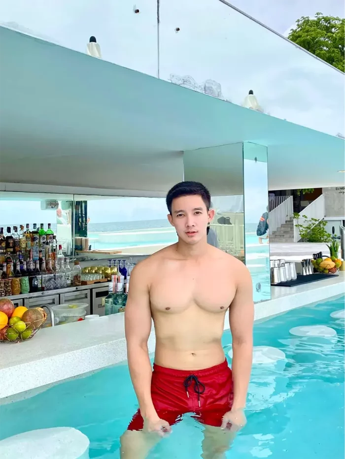 รีวิวปลูกผม_FACEBODY__10__ (3)